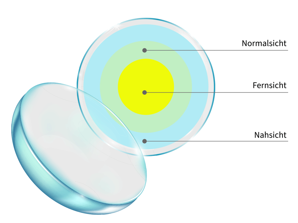 Gleitsicht Kontaklinsen Sehzonen